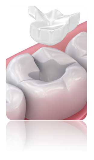 Impronta dentale digitale